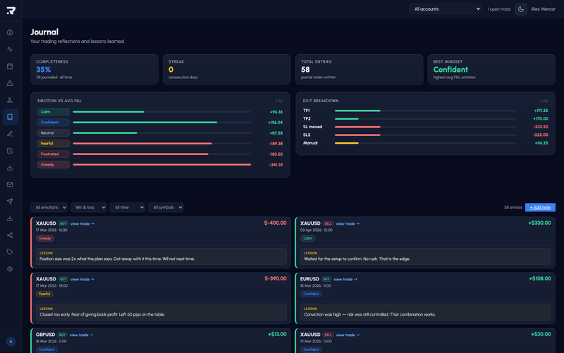 Trade Journal