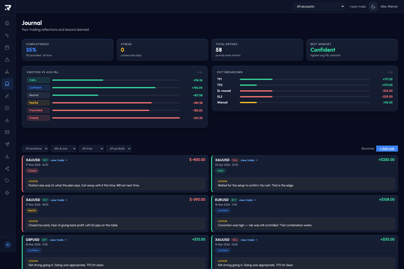 Trade Journal